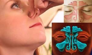болезни когда заложен нос без соплей, что делать?