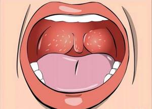 Что делать, если болит горло: советы, которые точно помогут
