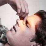 Что такое гиперпластический ринит: причины и лечение