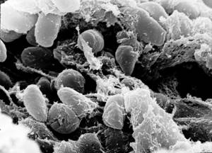 Чумная палочка — инфекционный агент бубонной чумы, также может вызывать пневмонию и септическую чуму. Различные формы этой бактерии привели к высокой смертности в эпидемиях. В результате септической чумы, вызванной этой бактерией, в промежуток с 1347 по 1353 годы умерла треть населения Европы.