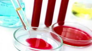 Для чего нужен общий анализ крови при гайморите? А также основные проявления заболевания