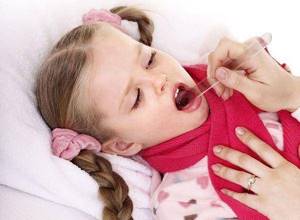 Фарингит гранулезный симптомы у ребенка лечение