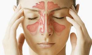 Головная боль при воспалении носовых пазух