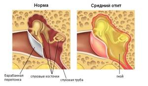 Головная боль в левой затылочной части головы за ухом