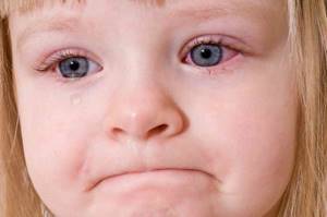хронический синусит симптомы и лечение у детей