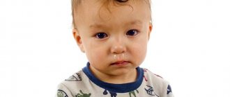 how and what to treat a runny nose with adenoids in children
