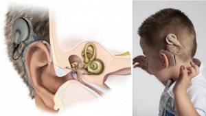 как проверить внутреннее ухо
