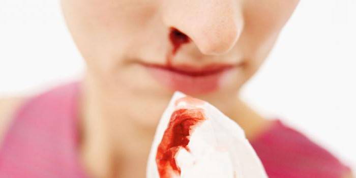 Как сделать так чтоб шла кровь из носа