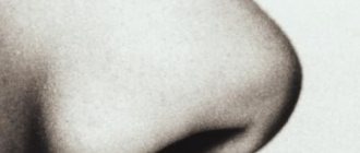 Как справиться с насморком