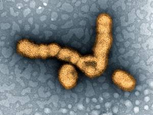 Колоризированная фотография поражённых вирусом H1N1 частиц.