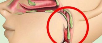 комок между носом и горлом