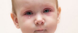 Красные глаза у маленького ребенка