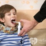 Лечение ангины и тонзиллита должно проводиться под врачебным контролем