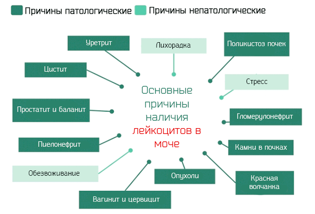 Наличие повышенный. Лейкоциты в моче причины. Что значит непатологические причины.