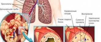 Мокрота в бронхах при бронхите