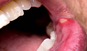 Может ли от зуба болеть горло