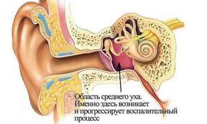 Область среднего уха при воспалении