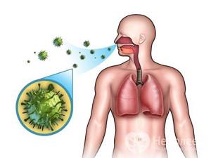 Основной причиной возникновения синусита являются вирусы или смешанная вирусно-бактериальная инфекция