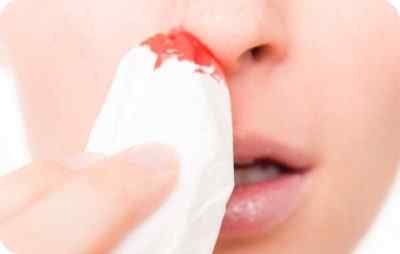 Основные причины носовых кровотечений