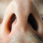 Ожог слизистой носа: лечение и симптомы, чем лечить