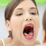 Почему зудит во рту: чтобы избавиться от неприятного симптома, найдите его причину