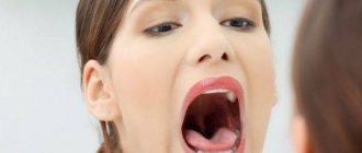 Почему зудит во рту: чтобы избавиться от неприятного симптома, найдите его причину