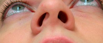Причины заложенного носа