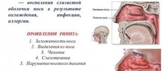 причины заложенности одной ноздри
