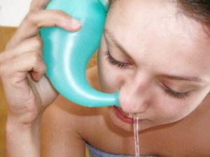 Процедура промывания носа методом перемещения жидкости при гайморите