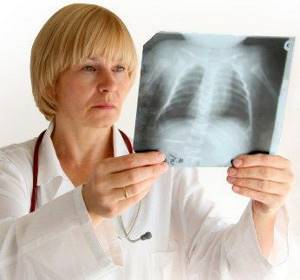 Рентгенография грудной клетки – один из достоверных методов диагностики