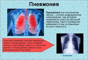 симптомы пневмонии