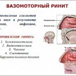 Симптомы ринита