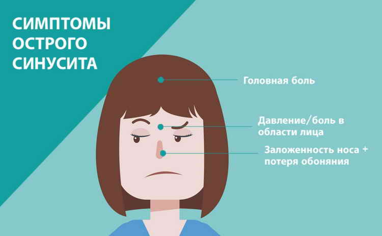 синусит симптомы и лечение у детей комаровский