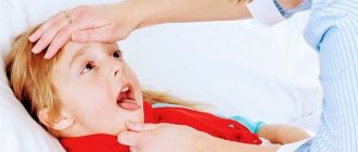 Сколько заразна ангина? Как заболевают ангиной? Препараты для профилактики ангины