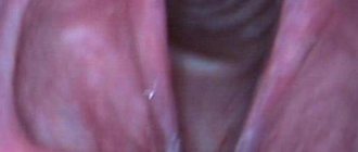 строение гортани рисунок