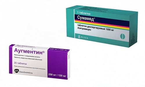 Сумамед или Аугментин относятся к антибиотикам широкого спектра действия
