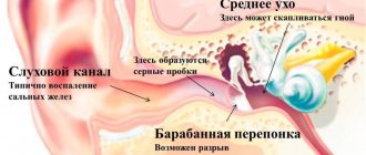 ушная перепонка фото