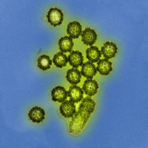 Вирус гриппа H1N1, штамм А этого гриппа в 2009 году стал известен как «свиной грипп».