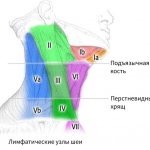 Воспаление лимфоузлов на шее: симптомы и лечение шейного лимфаденита, причины почему болят лимфоузлы на шее