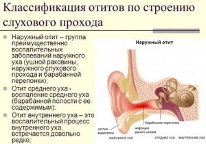 Воспаление уха. Симптомы и лечение в домашних условиях. Лекарства, препараты, народные методы, антибиотики