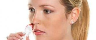 Взаимосвязь головных болей и кровотечений из носа